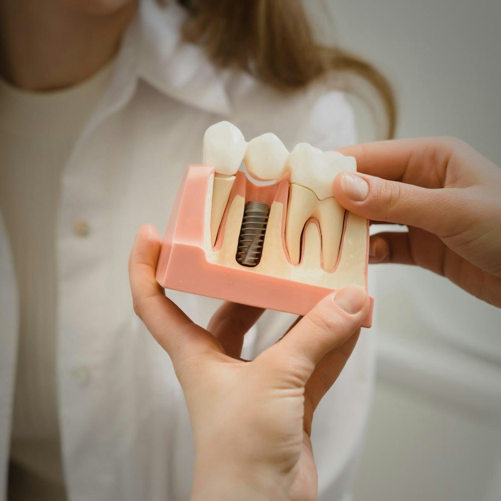 Illustration of restoration attaching to dental implant