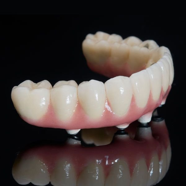 Implant denture
