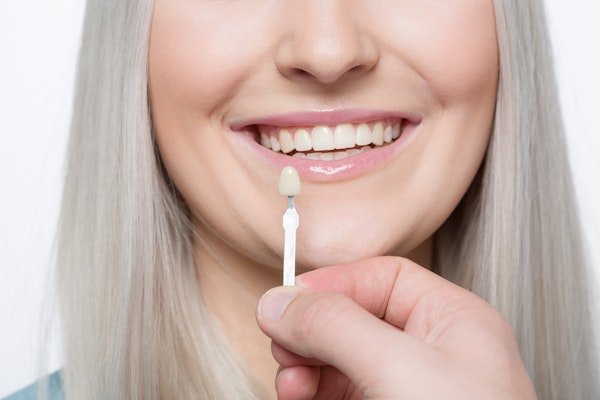 Woman comparing a veneer to her teeth